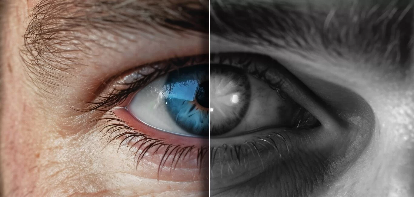 Understanding Glaucoma: A Comprehensive Guide